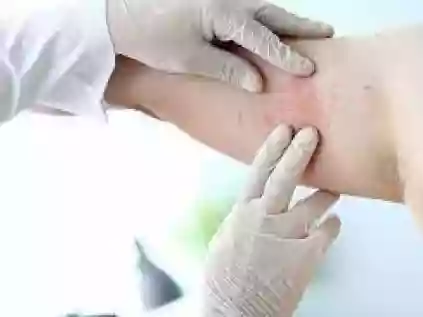 Quando procurar um médico alergista?